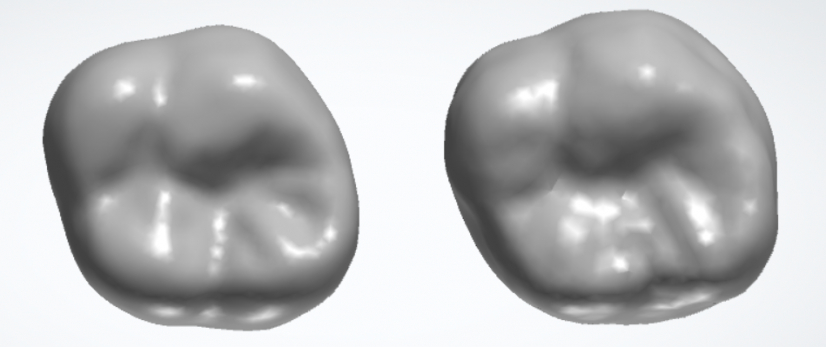 天然牙齒（左）與生成式AI設計的牙冠（右）比較。
 
